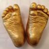 baby foot casts jo inglis-lyons