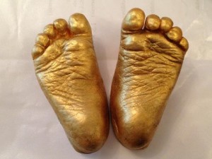 baby foot casts jo inglis-lyons